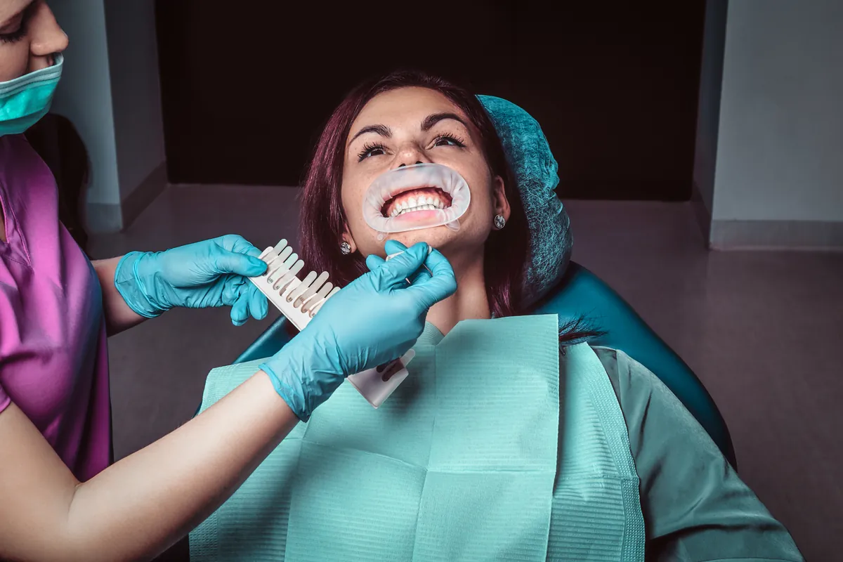 Dentista comparando a cor dos dentes com a escala de cores antes do clareamento dental