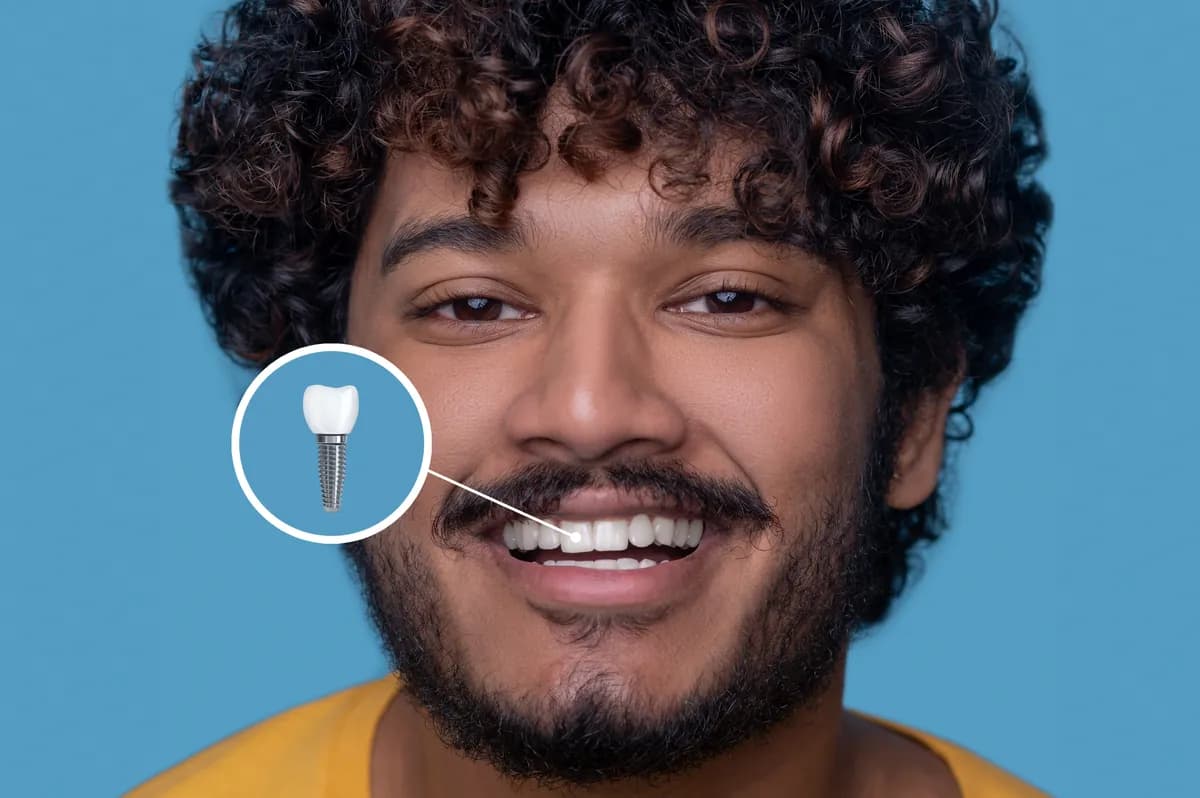 Homem sorrindo com ilustração de implante dentário