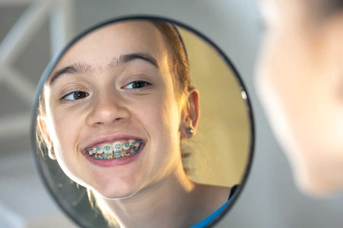 Adolescente com aparelho ortodôntico sorrindo para o espelho